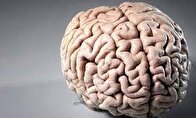 یک کرم زنده در مغز مرد ۵۲ ساله کشف شد! +عکس