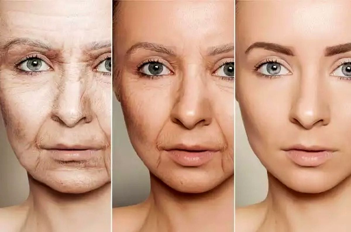شکل‌گیری چین‌وچروک پوستی دقیقا از چه سنی شروع می‌شود؟
