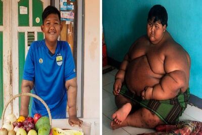 چاق ترین کودک دنیا که با کاهش وزن خود شگفتی ساز شد!