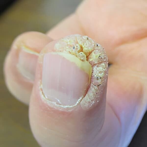 مراقب سرایت این بیماری خطرناک در آرایشگاه‌های زنانه باشید