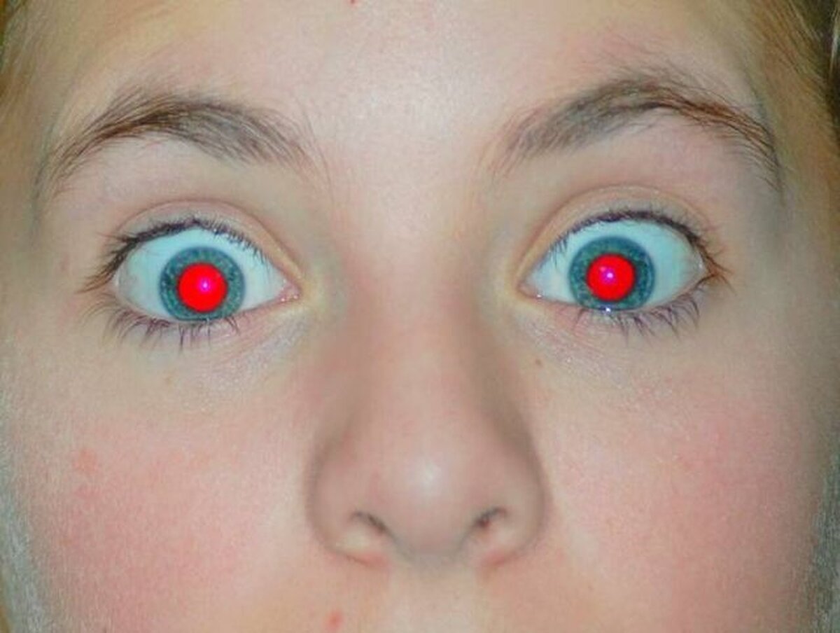 قرمز شدن مردمک چشم در عکس‌ها نشانه بیماری است؟