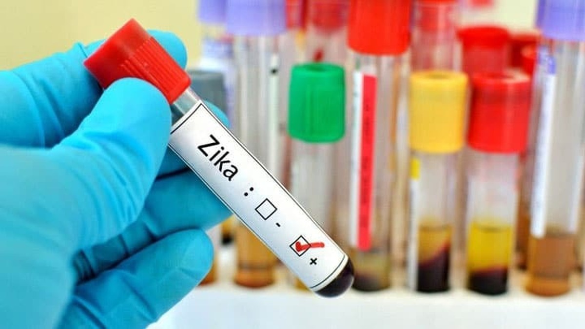 ویروس زیکا چیست؟