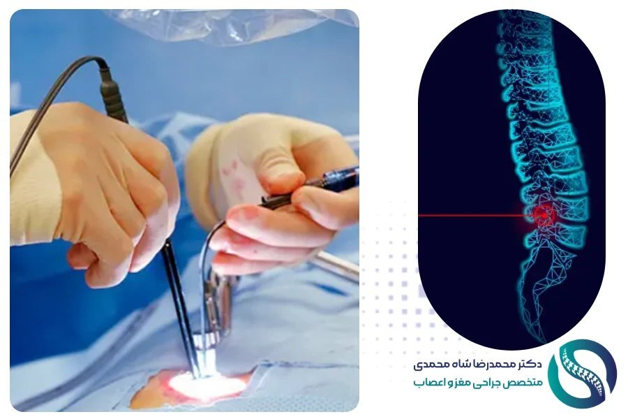 دکتر شاه محمدی متخصص جراحی دیسک کمر در تهران دکتر شاه محمدی متخصص جراحی دیسک کمر در تهران