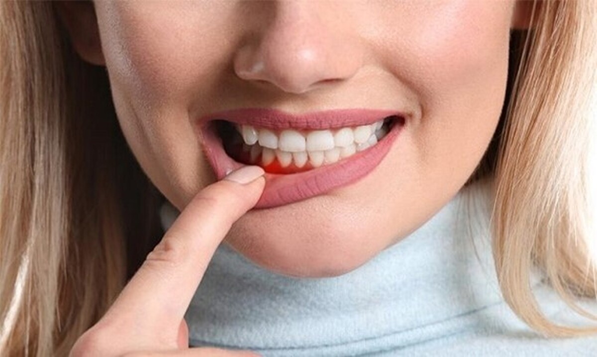 تأثیر استرس بر سلامت دهان و دندان