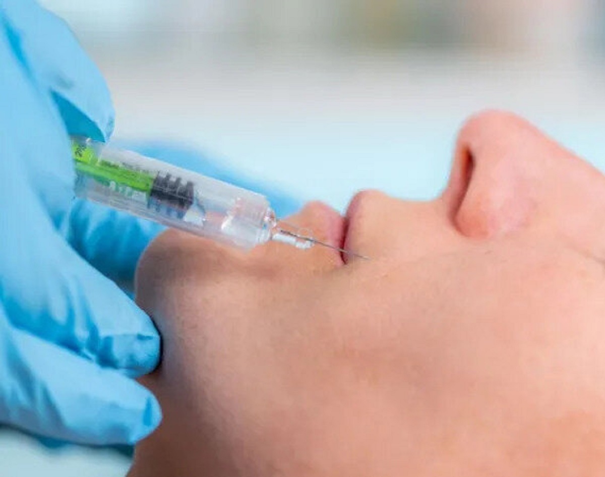 هشدار در مورد فیلرهای صورت