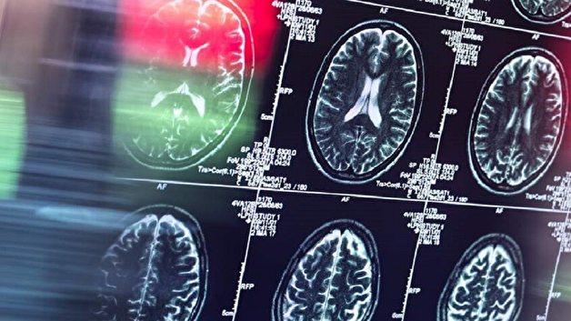 تأثیر عوامل روزانه بر شکل‌گیری عادت